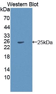 Polyclonal Antibody to Hermansky Pudlak Syndrome Protein 4 (HPS4)