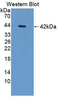 Polyclonal Antibody to Insulin Like Growth Factor 2 mRNA Binding Protein 3 (IGF2BP3)