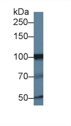 Polyclonal Antibody to Inositol Polyphosphate-4-Phosphatase Type I 107kDa (INPP4A)