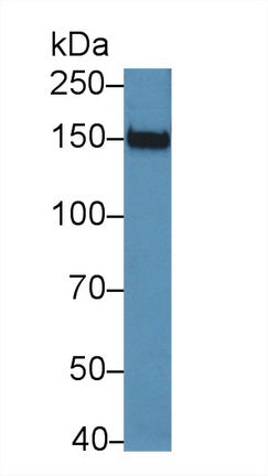 Polyclonal Antibody to Jagged 2 Protein (JAG2)