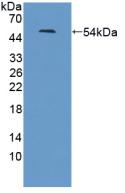 Polyclonal Antibody to Leucine Rich Repeat Neuronal Protein 1 (LRRN1)