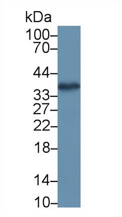 Polyclonal Antibody to Aminoacyl tRNA Synthetase Complex Interacting Multifunctional Protein 1 (AIMP1)