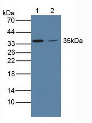 Polyclonal Antibody to Otubain 1 (OTUB1)