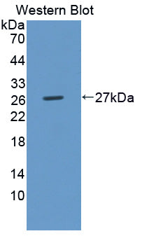 Polyclonal Antibody to UL16 Binding Brotein 2 (ULBP2)