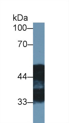 Polyclonal Antibody to N-myc Downstream Regulated Gene 2 (NDRG2)