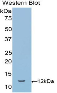 Polyclonal Antibody to Semaphorin 3E (SEMA3E)