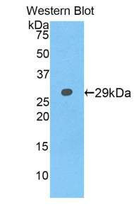 Polyclonal Antibody to Neurofascin (NFASC)