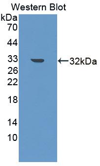 Polyclonal Antibody to NADH Dehydrogenase, Quinone 1 (NQO1)