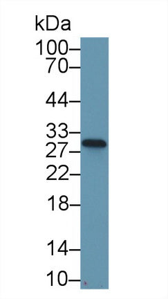 Polyclonal Antibody to NADH Dehydrogenase, Quinone 1 (NQO1)