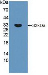Polyclonal Antibody to Ribosomal Protein S6 Kinase Beta 1 (RPS6Kb1)