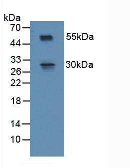 Polyclonal Antibody to R-Spondin 1 (RSPO1)