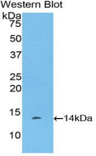 Polyclonal Antibody to R-Spondin 1 (RSPO1)