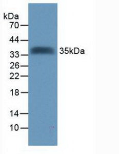 Polyclonal Antibody to Tomoregulin (TR)