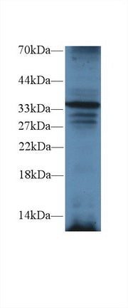 Polyclonal Antibody to TNFRSF1A Associated Via Death Domain Protein (TRADD)