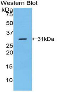 Polyclonal Antibody to TNFRSF1A Associated Via Death Domain Protein (TRADD)