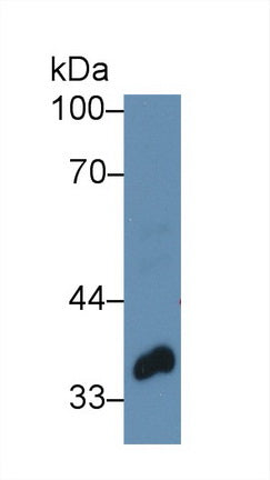 Polyclonal Antibody to Twinfilin 1 (TWF1)