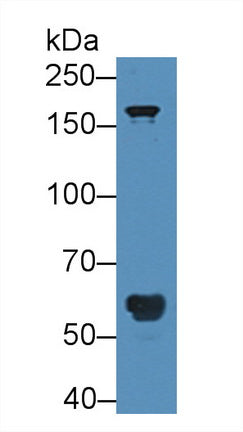 Polyclonal Antibody to POTE Ankyrin Domain Family, Member G (POTEG)