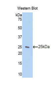 Polyclonal Antibody to Zinc Finger, AN1-Type Domain Protein 6 (ZFAND6)
