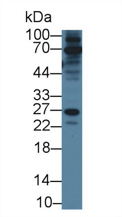 Polyclonal Antibody to RAB37, Member RAS Oncogene Family (RAB37)