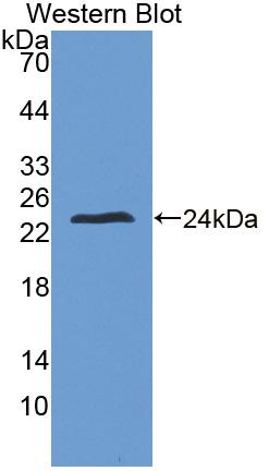 Polyclonal Antibody to Zinc Finger Homeobox Protein 4 (ZFHX4)