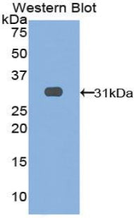 Polyclonal Antibody to Leucine Rich Repeats And Immunoglobulin Like Domains Protein 3 (LRIG3)