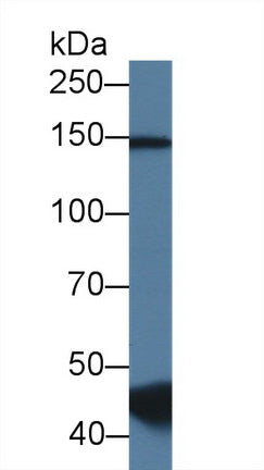 Polyclonal Antibody to RNA Binding Motif Protein 20 (RBM20)