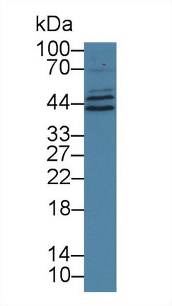 Polyclonal Antibody to Hepatocellular Carcinoma Related Protein 1 (HCRP1)