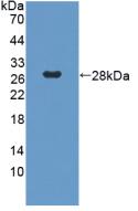 Polyclonal Antibody to G Protein Beta Subunit Like Protein (GbL)