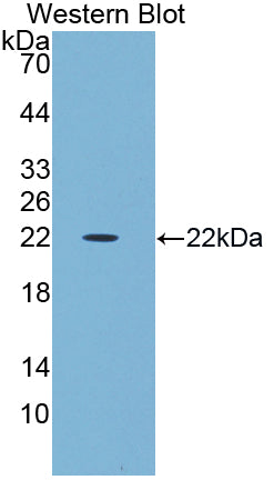 Polyclonal Antibody to Amy1 Associated Protein Expressed In Testis (AAT1)
