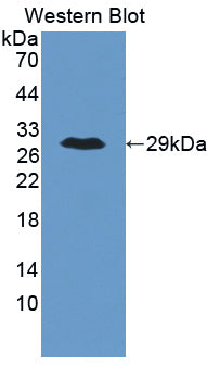 Polyclonal Antibody to Angiopoietin Like Protein 6 (ANGPTL6)