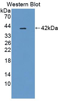 Polyclonal Antibody to Pim-3 Oncogene (PIM3)