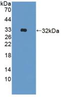 Polyclonal Antibody to A Disintegrin And Metalloprotease 33 (ADAM33)
