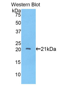 Polyclonal Antibody to A Disintegrin And Metalloproteinase With Thrombospondin 12 (ADAMTS12)
