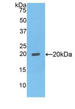 Polyclonal Antibody to Fc Fragment Of IgG Binding Protein (FcgBP)