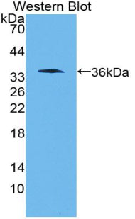 Polyclonal Antibody to Wingless Type MMTV Integration Site Family, Member 10B (WNT10B)