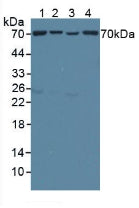 Polyclonal Antibody to Translocase Of Outer Mitochondrial Membrane 70A (TOMM70A)