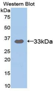 Polyclonal Antibody to Suppression Of Tumorigenicity 14 (ST14)