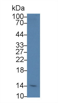 Polyclonal Antibody to SH2 Domain Containing Protein 1A (SH2D1A)