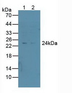 Polyclonal Antibody to Proteasome 26S Subunit, Non ATPase 10 (PSMD10)