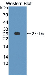 Polyclonal Antibody to Pim-2 Oncogene (PIM2)