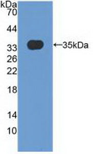Polyclonal Antibody to Matrix Remodelling Associated Protein 5 (MXRA5)