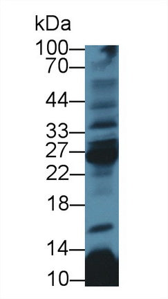 Polyclonal Antibody to Cluster Of Differentiation 8b (CD8b)