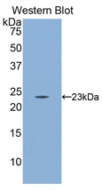 Polyclonal Antibody to Cluster Of Differentiation 8b (CD8b)