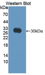 Polyclonal Antibody to ATP Binding Cassette Transporter C10 (ABCC10)