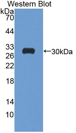 Polyclonal Antibody to ATPase, Na+/K+ Transporting Beta 4 Polypeptide (ATP1b4)