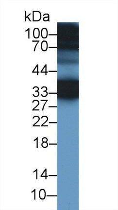 Polyclonal Antibody to Cellular Repressor Of E1A Stimulated Genes 1 (CREG1)