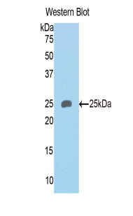 Polyclonal Antibody to Semaphorin 4B (SEMA4B)