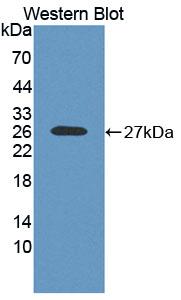 Polyclonal Antibody to Ribonuclease A10 (RNASE10)