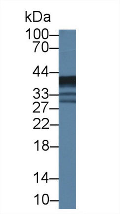 Polyclonal Antibody to Epoxide Hydrolase 4 (EPHX4)