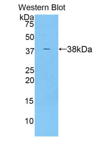 Polyclonal Antibody to Angiopoietin Like Protein 7 (ANGPTL7)